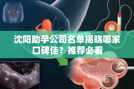 沈阳助孕公司名单揭晓哪家口碑佳？推荐必看