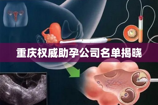 重庆权威助孕公司名单揭晓