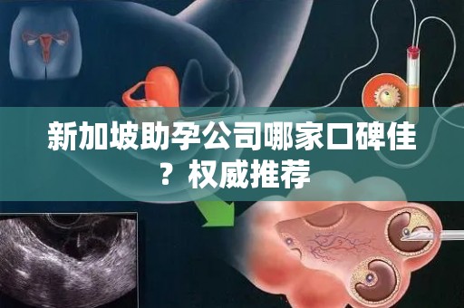 新加坡助孕公司哪家口碑佳？权威推荐