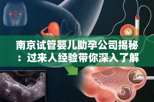 南京试管婴儿助孕公司揭秘：过来人经验带你深入了解