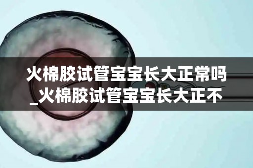 火棉胶试管宝宝长大正常吗_火棉胶试管宝宝长大正不正常解密,与普通人是否一样答案揭晓_试管百科