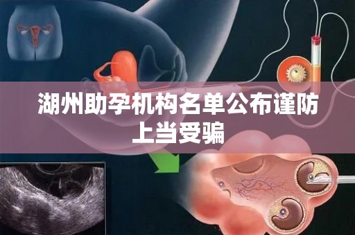 湖州助孕机构名单公布谨防上当受骗