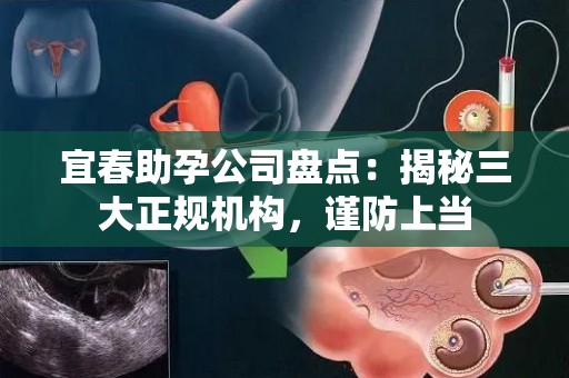 宜春助孕公司盘点：揭秘三大正规机构，谨防上当