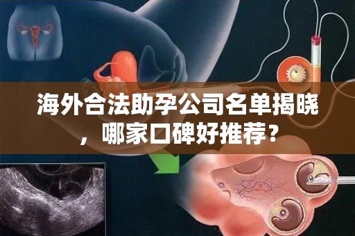 海外合法助孕公司名单揭晓，哪家口碑好推荐？