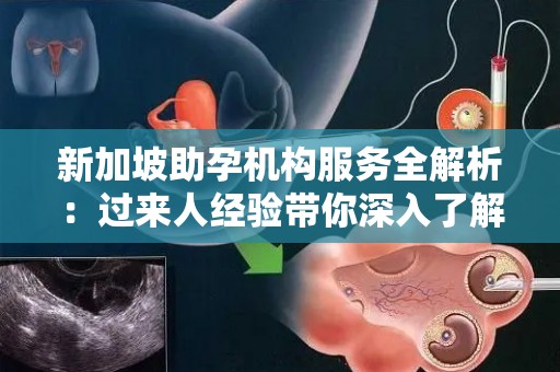 新加坡助孕机构服务全解析：过来人经验带你深入了解