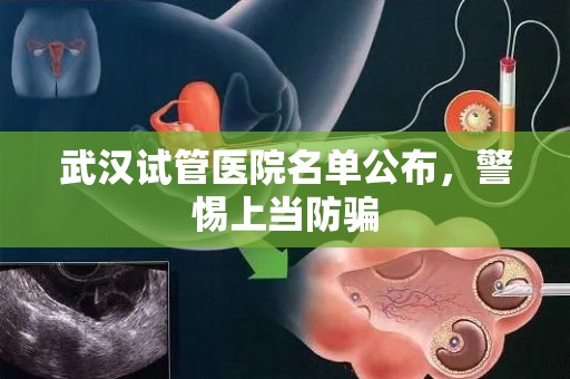 武汉试管医院名单公布，警惕上当防骗