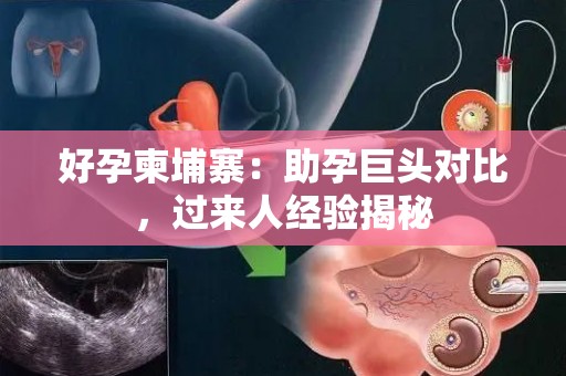 好孕柬埔寨：助孕巨头对比，过来人经验揭秘