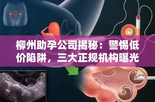 柳州助孕公司揭秘：警惕低价陷阱，三大正规机构曝光