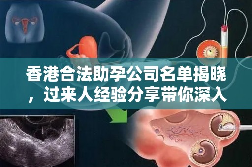 香港合法助孕公司名单揭晓，过来人经验分享带你深入了解