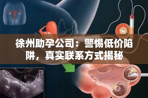 徐州助孕公司：警惕低价陷阱，真实联系方式揭秘