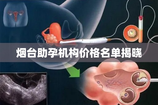 烟台助孕机构价格名单揭晓