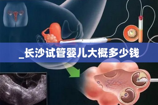 _长沙试管婴儿大概多少钱
