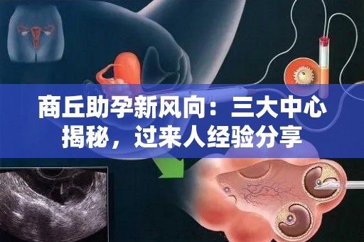 商丘助孕新风向：三大中心揭秘，过来人经验分享