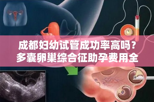 成都妇幼试管成功率高吗？多囊卵巢综合征助孕费用全透明!