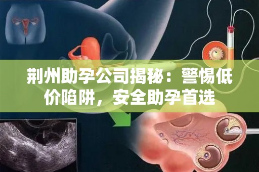 荆州助孕公司揭秘：警惕低价陷阱，安全助孕首选