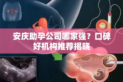 安庆助孕公司哪家强？口碑好机构推荐揭晓