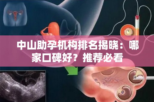 中山助孕机构排名揭晓：哪家口碑好？推荐必看