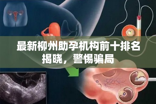 最新柳州助孕机构前十排名揭晓，警惕骗局