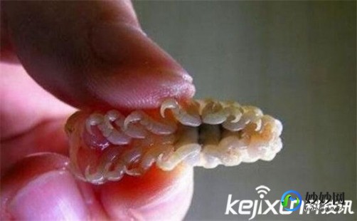 恶心 寄生虫,最恶心的人体寄生虫