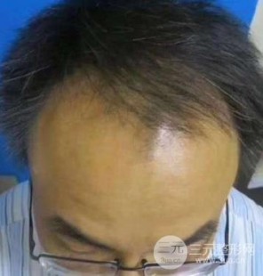 盛植发可靠吗,盛植发靠谱吗