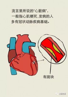 心梗最怕的克星,心梗最怕的克星