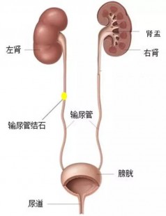 三门齐开有多痛,开三指相当于什么疼