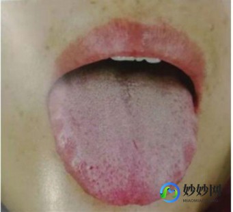 身体太虚弱,身体虚怎么办