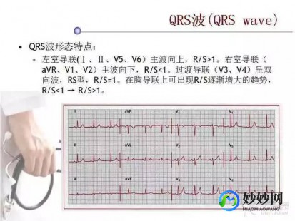 v2v3v4抬高,轻度ST段抬高V2V3V4严重吗田洪波