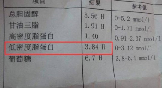 5.55,胆固醇5.55严重吗？