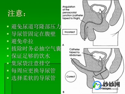 尿道责罚,尿道责罚膀胱训练是什么