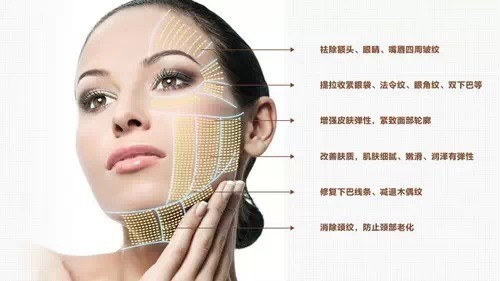 热玛吉效果,热玛吉有什么功效