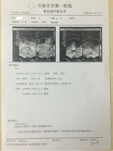 吃什么能治疗子宫肌瘤消失,吃什么可以消除子宫肌瘤