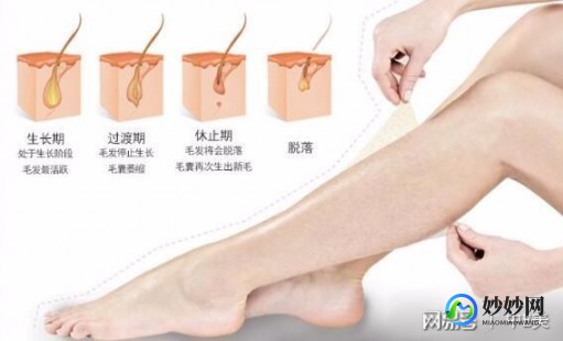 激光脱毛有用吗,激光脱毛有效果吗