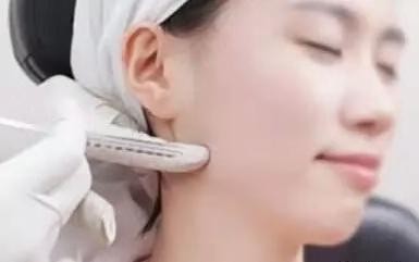 瘦脸针安全吗,瘦脸针安全吗