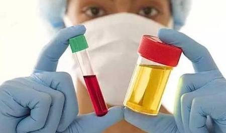 492,尿酸492 mu mol L怎么降到正常