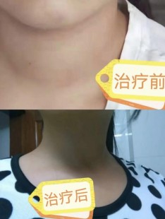 多年不孕女性的隐秘征兆你知道多少