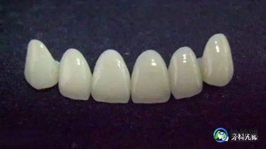 全瓷烤瓷牙价格,烤瓷牙和全瓷牙价格
