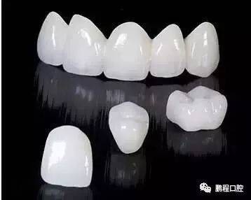 全瓷烤瓷牙价格,烤瓷牙和全瓷牙价格