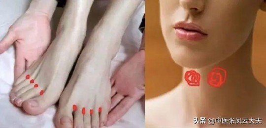 结节可以揉开吗,结节可以揉开吗