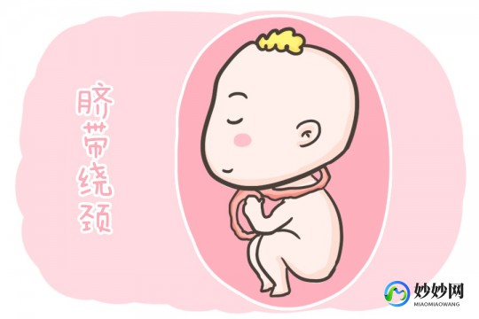 脐带绕颈一周怎么办,脐带绕颈一周怎么办