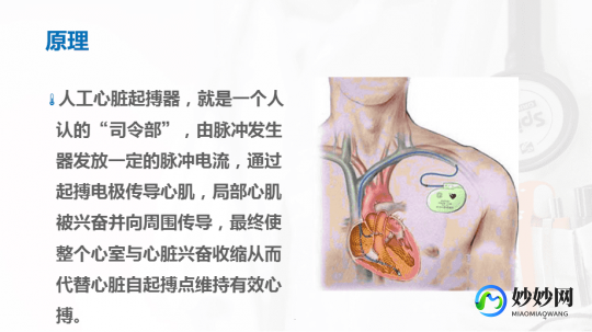 永久起搏器,植入心脏起搏器时永久性的吗