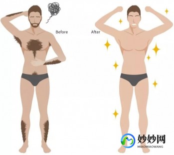 男性脱毛,男士怎么脱毛