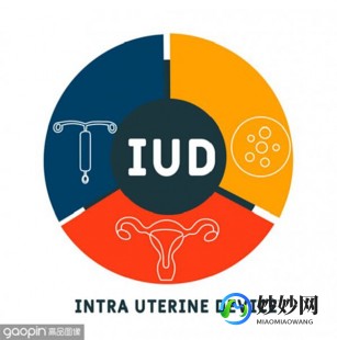 iud,IUD避孕是什么意思