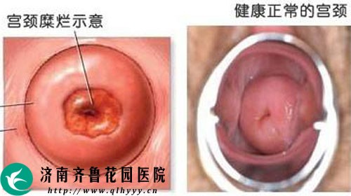 有白带是排卵吗,白带是排卵期的表现吗