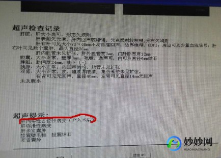 什么是甲胎蛋白,甲胎蛋白是什么