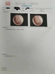 外伤性鼓膜穿孔,耳外伤导致的耳膜穿孔怎么办
