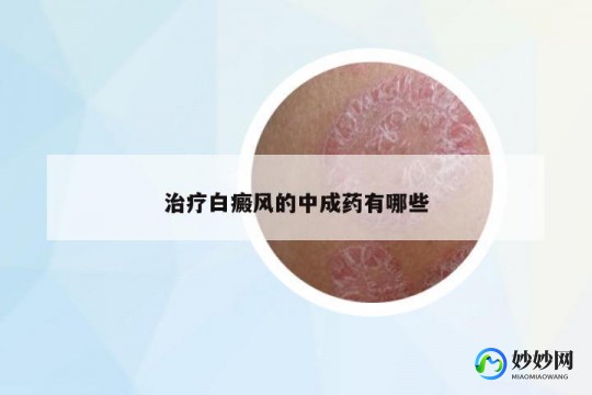 白癜风的治疗药物,有什么药可以治白癜风