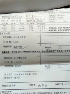 21三体临界风险,21三体临界风险常见吗