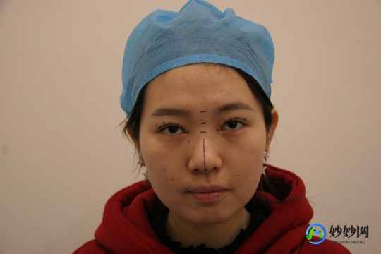 胶原蛋白注射隆鼻,胶原蛋白可以隆鼻吗