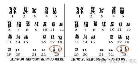 性染色体数目异常试管技术突破助力生育新希望
